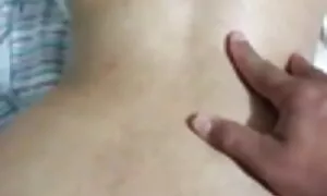 गुदा प्रलाप्समा पत्न ...