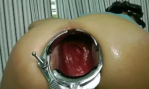 आमाको गुदा मुट्ठीको  ...